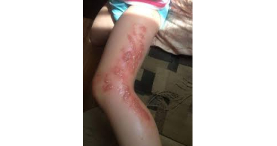 BARSZCZ SOSNOWSKIEGO